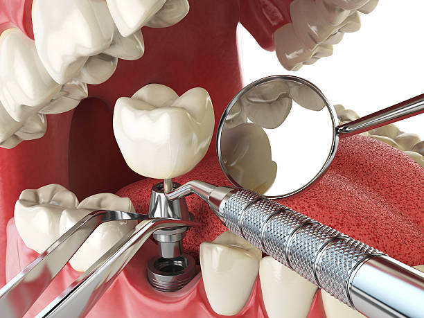 Best Emergency Treatment for Dental Infections or Abscesses in Decorah, IA